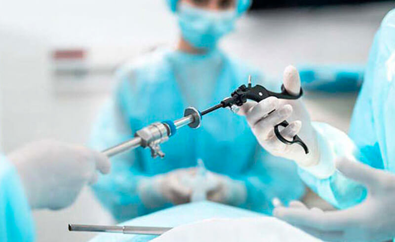 Diagnostic Laparscopy 1