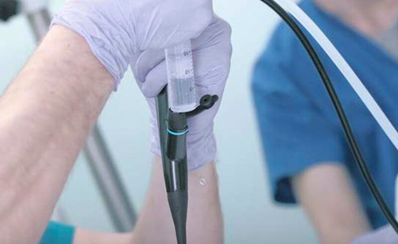 Gyne-Uro-Cystoscopy Procedure